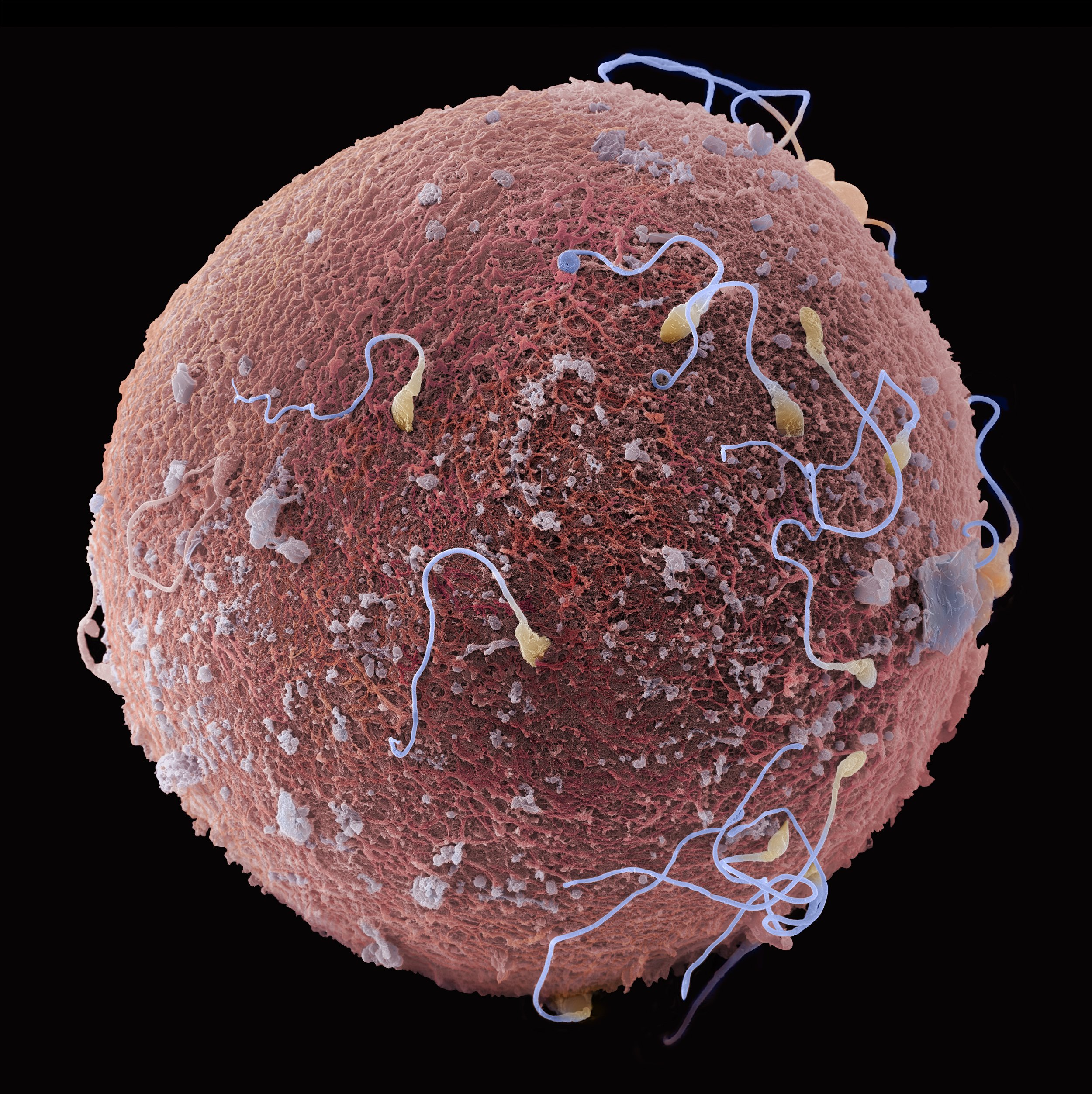Observe Sperm Binding on the Oocyte Surface during IVF