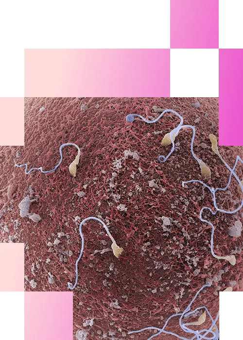 3-3-Human oocyte-mobile