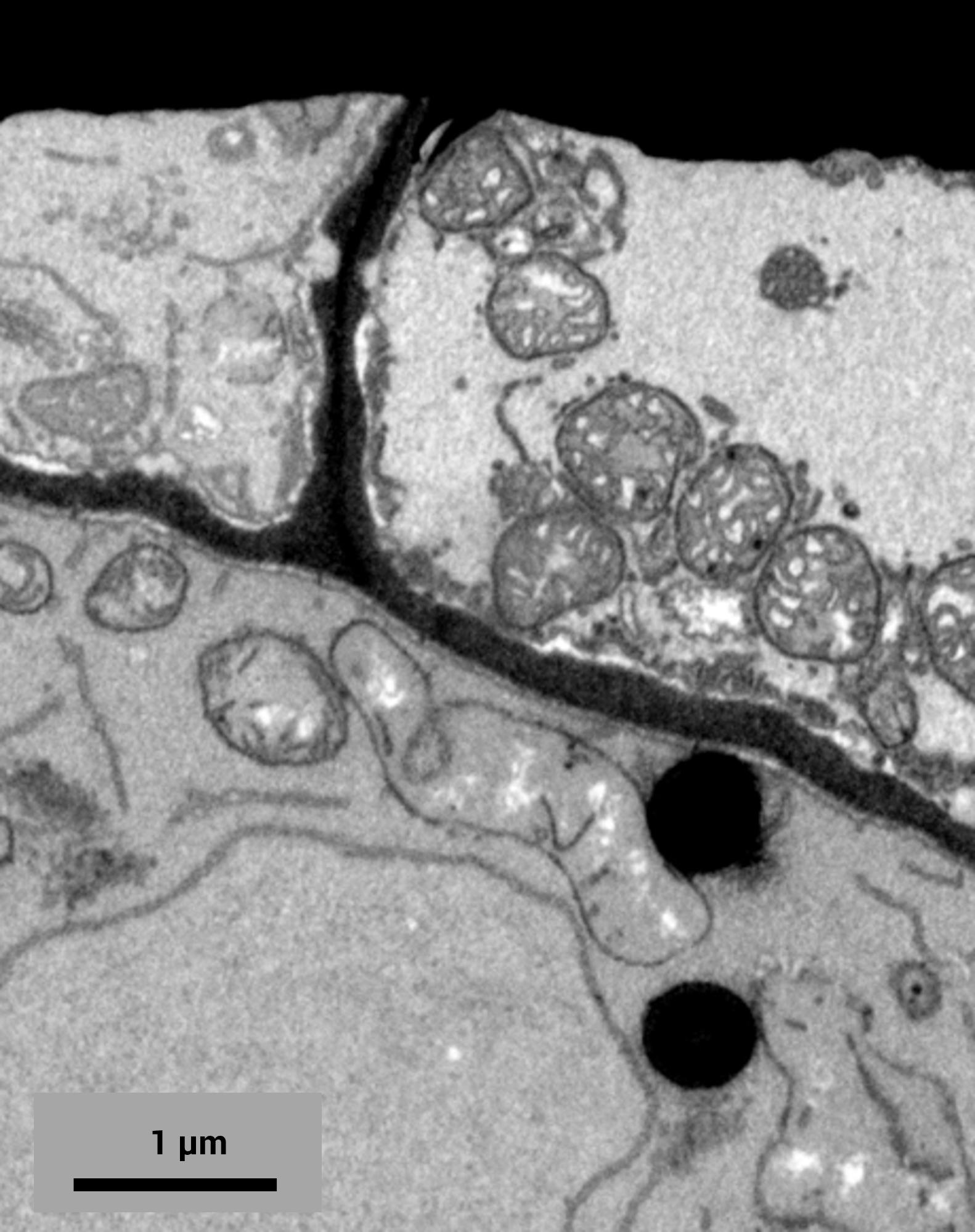 RevealCellular Interfaces in Phloem Tissue with Precise SEM Imaging
