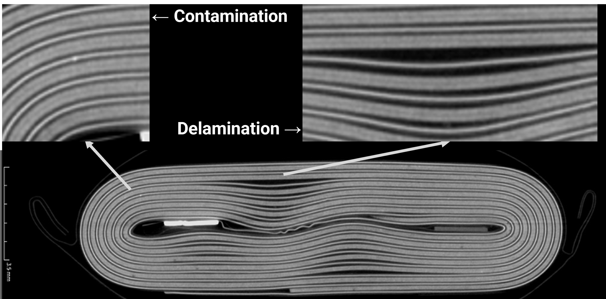Detect Internal Battery Defects Without Disassembly