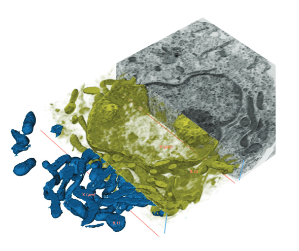 Cancer cell HeLa – 3D visualization of nucleus with nucleolus and mitochondria (blue)