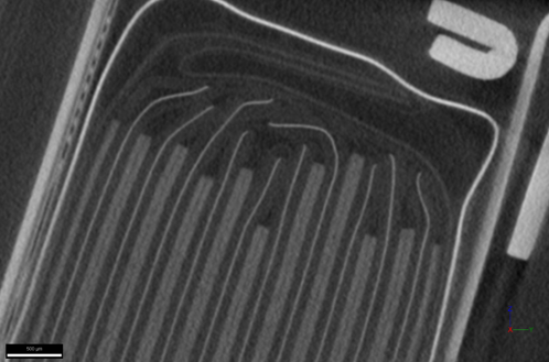 Identify Anode Overhang and Edge Effects in Wearable Batteries