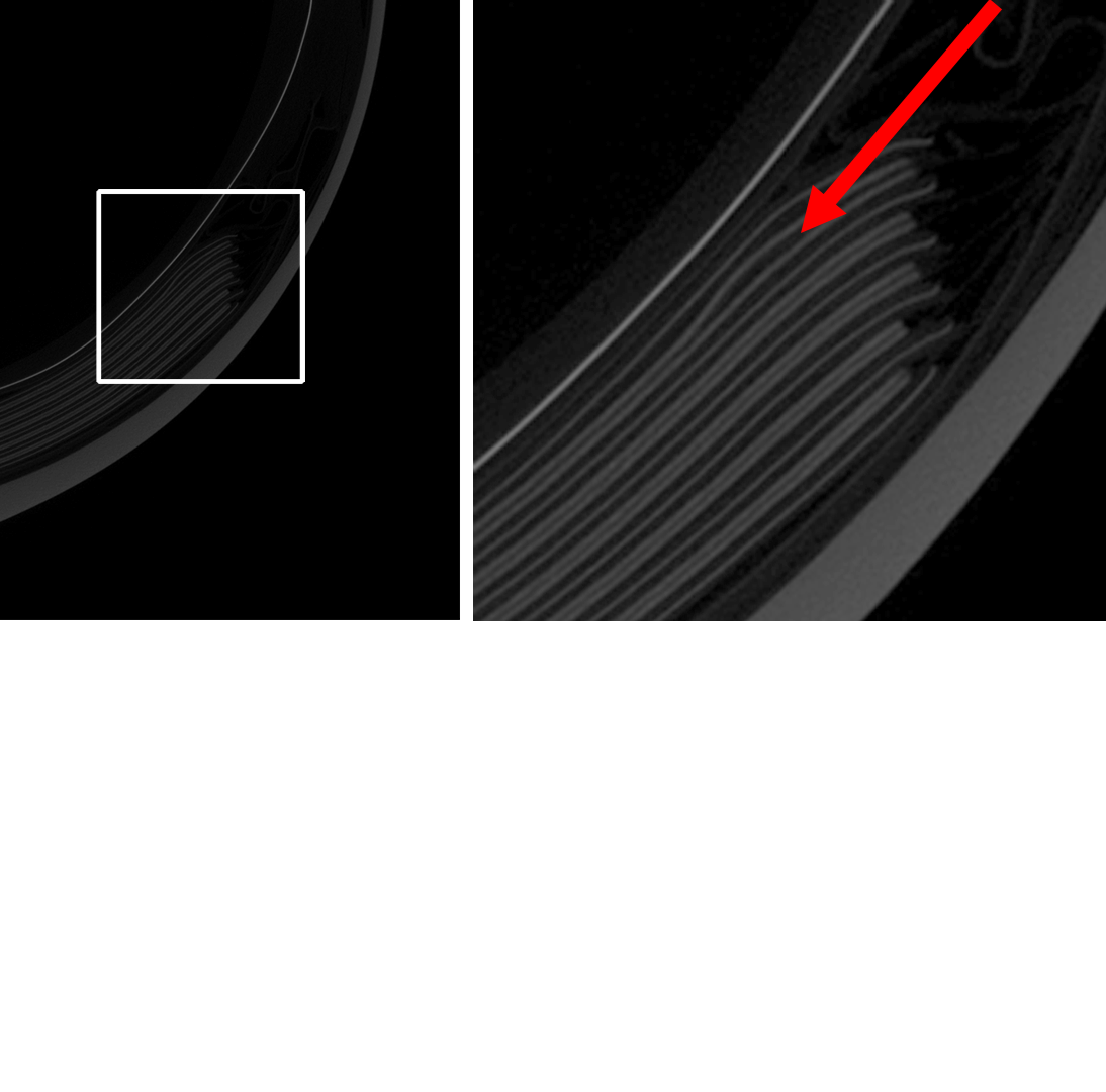 Empower Safer Design in Battery-Integrated Wearables