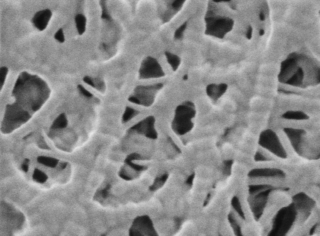 4_Detailed SEM analysis of PP separator-1