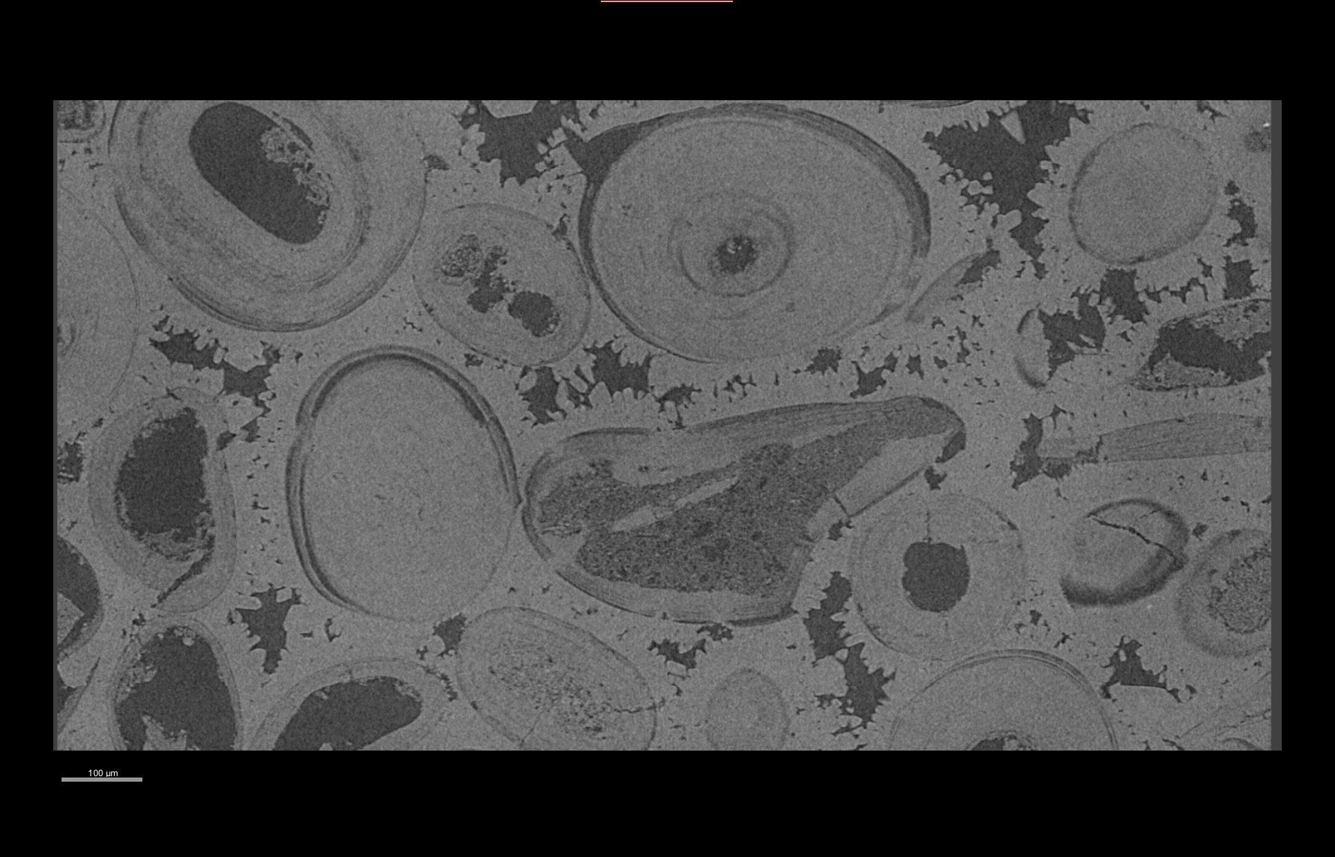 Reveal Microporosity in Carbonate Textures