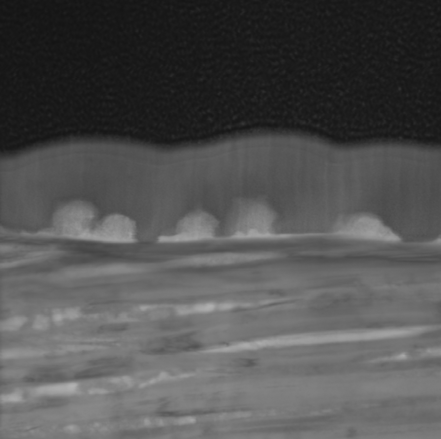 Detailed Cross-Sectional SEI Observation with STEM