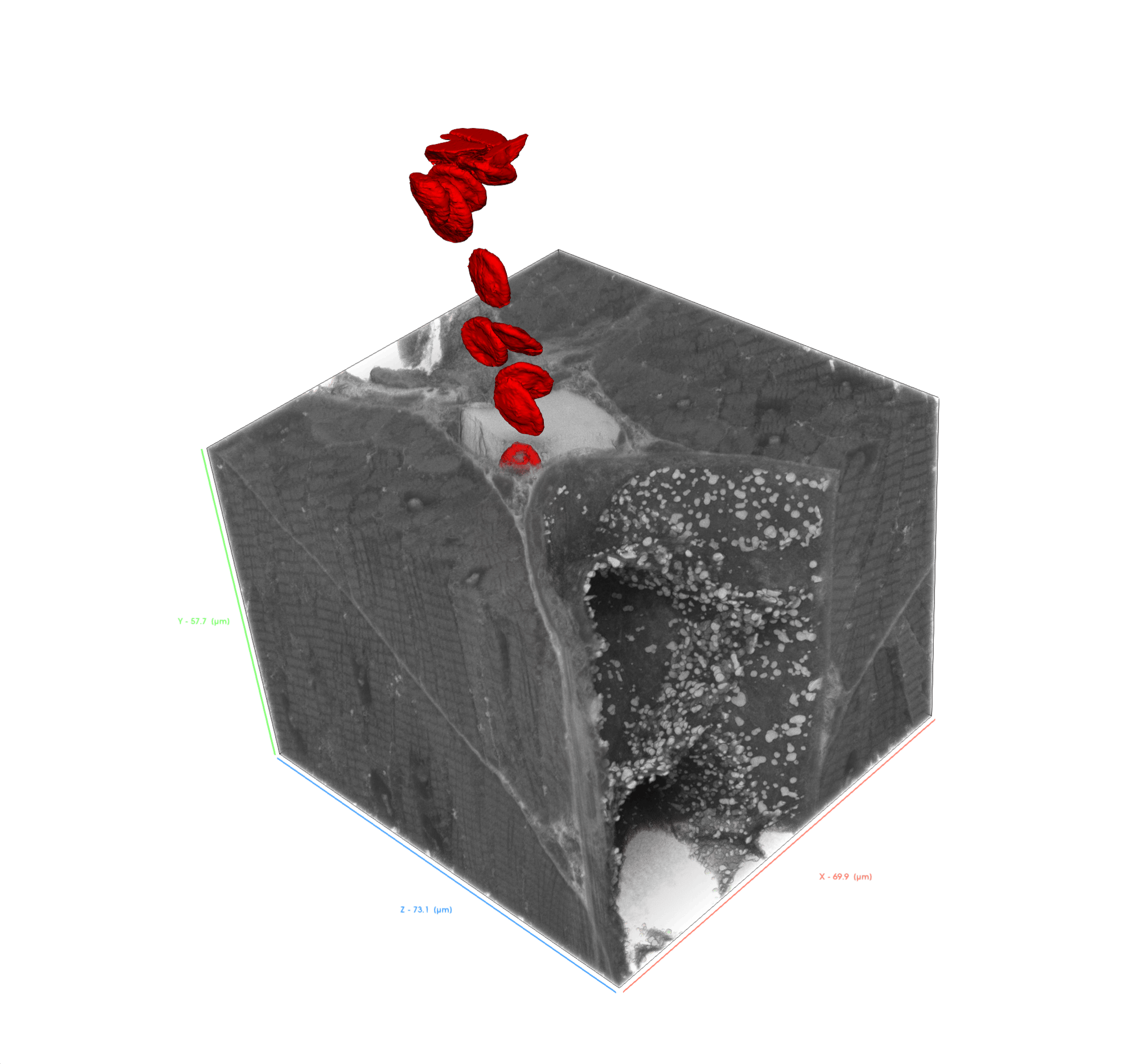 Reconstruct Zebrafish Tissue Networks in 3D Without Losing Context