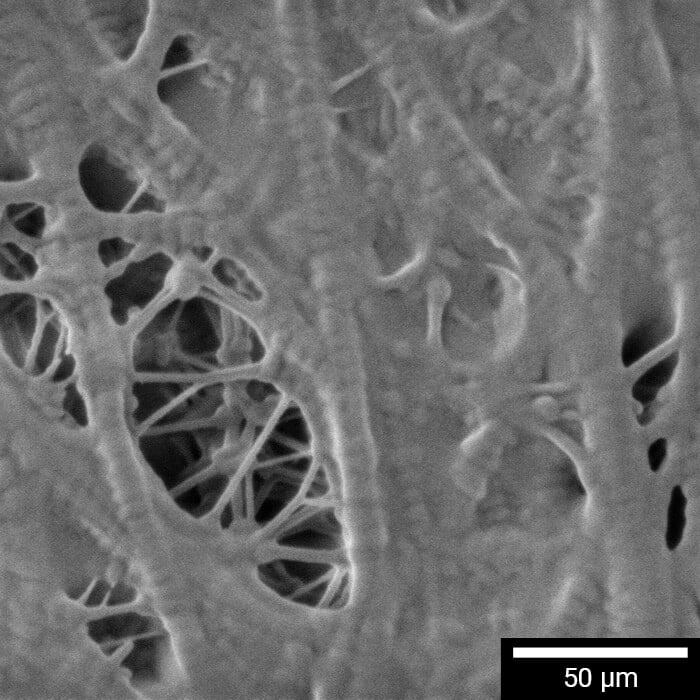 Ultra-high-resolution image of polypropylene battery separator