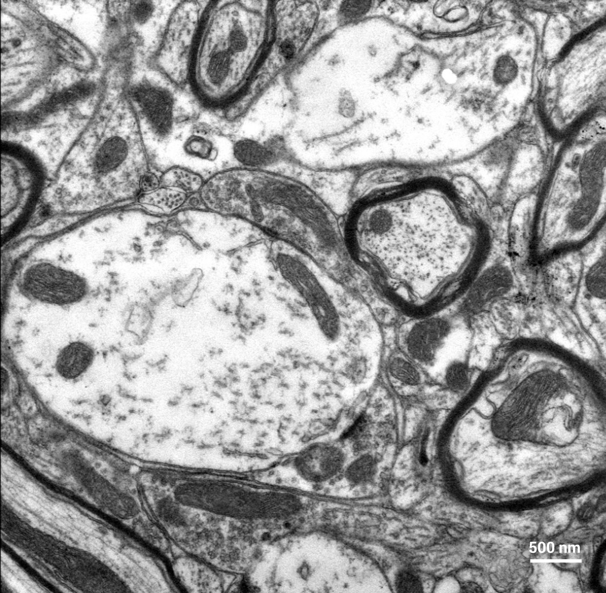 SOLARIS 2 Stem in SEM neural tissue.jpg