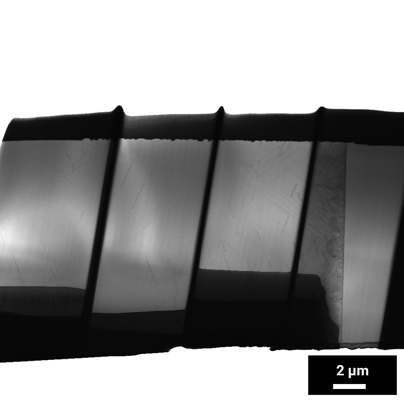 Gain Clear Structural Overview with Bright Field STEM Imaging in FIB-SEM