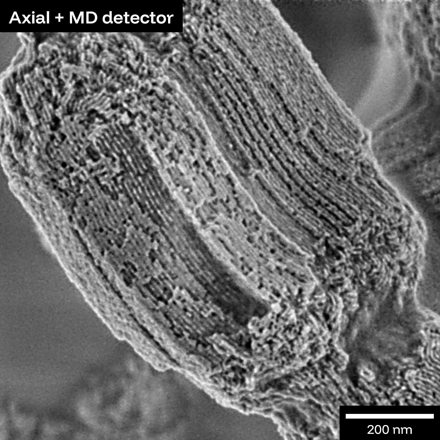UHR at low keV resolves nanoparticle featuress without beam damage or charge artifacts on the carrier.
