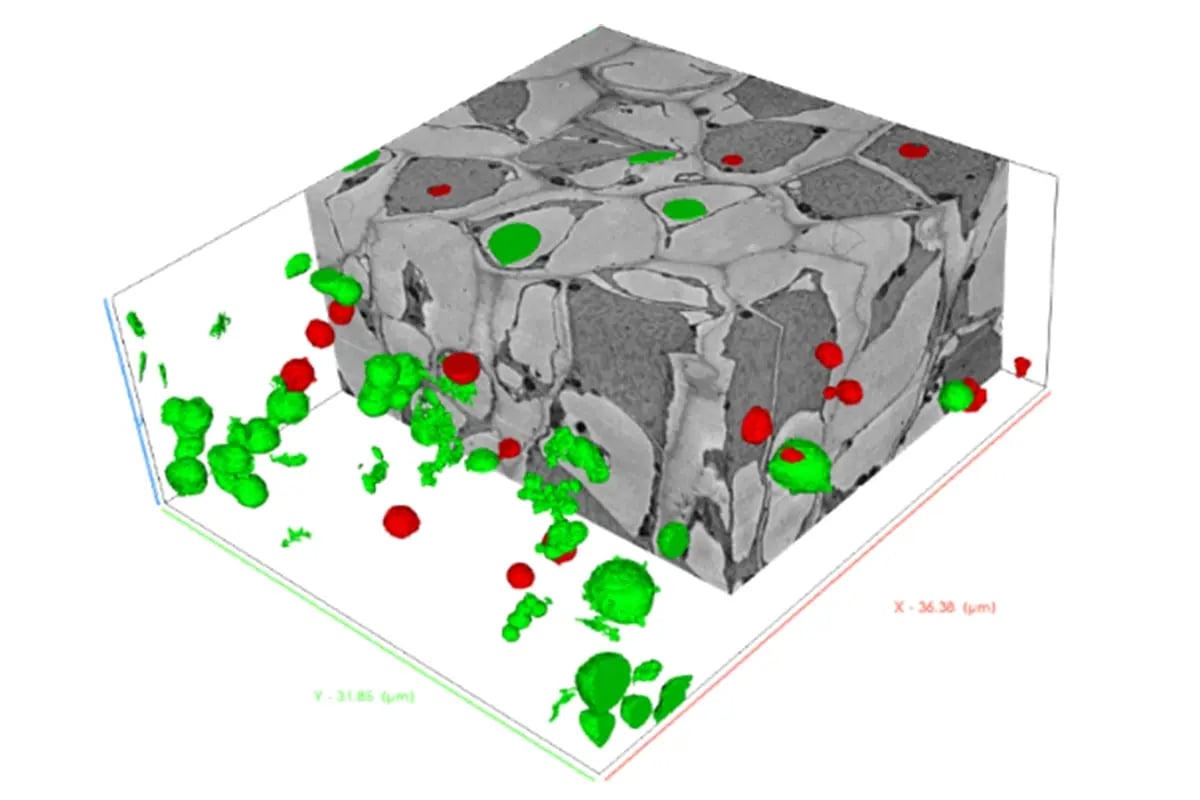 Ultrastructural Volume Analysis