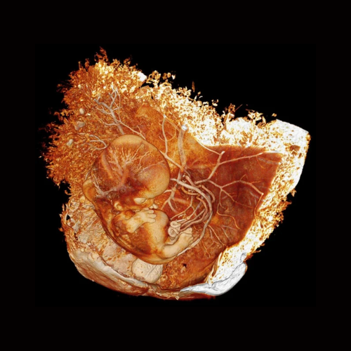 micro-ct-prenatal-care-early-human-development