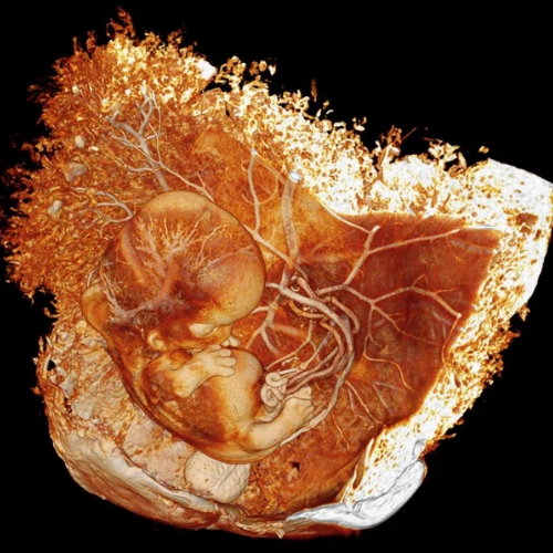 human-embryonic-micro ct imaging1