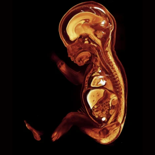 human-embryonic-micro ct imaging2
