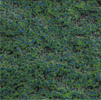 Dual Essence™ EDS elemental map of austempered ductile iron fractured surface captured with TESCAN MIRA XR UHR SEM for materials analysis.