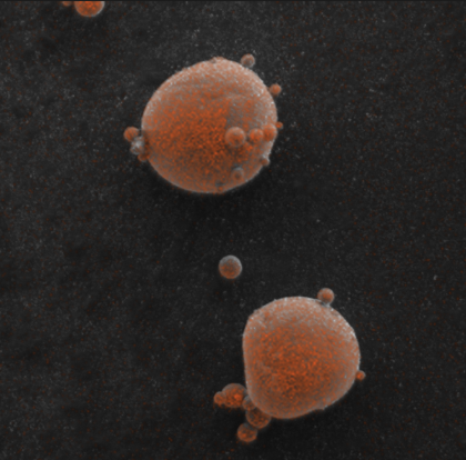 Dual Essence™ EDS elemental map of iron (Fe) distribution in LFP particles captured with TESCAN MIRA XR UHR SEM for materials research.