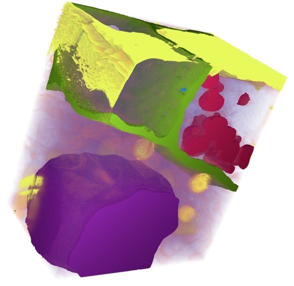 Segmentation of sieve plate of Arabidopsis thaliana root. The specimen was provided by EMBI, University of Helsinki