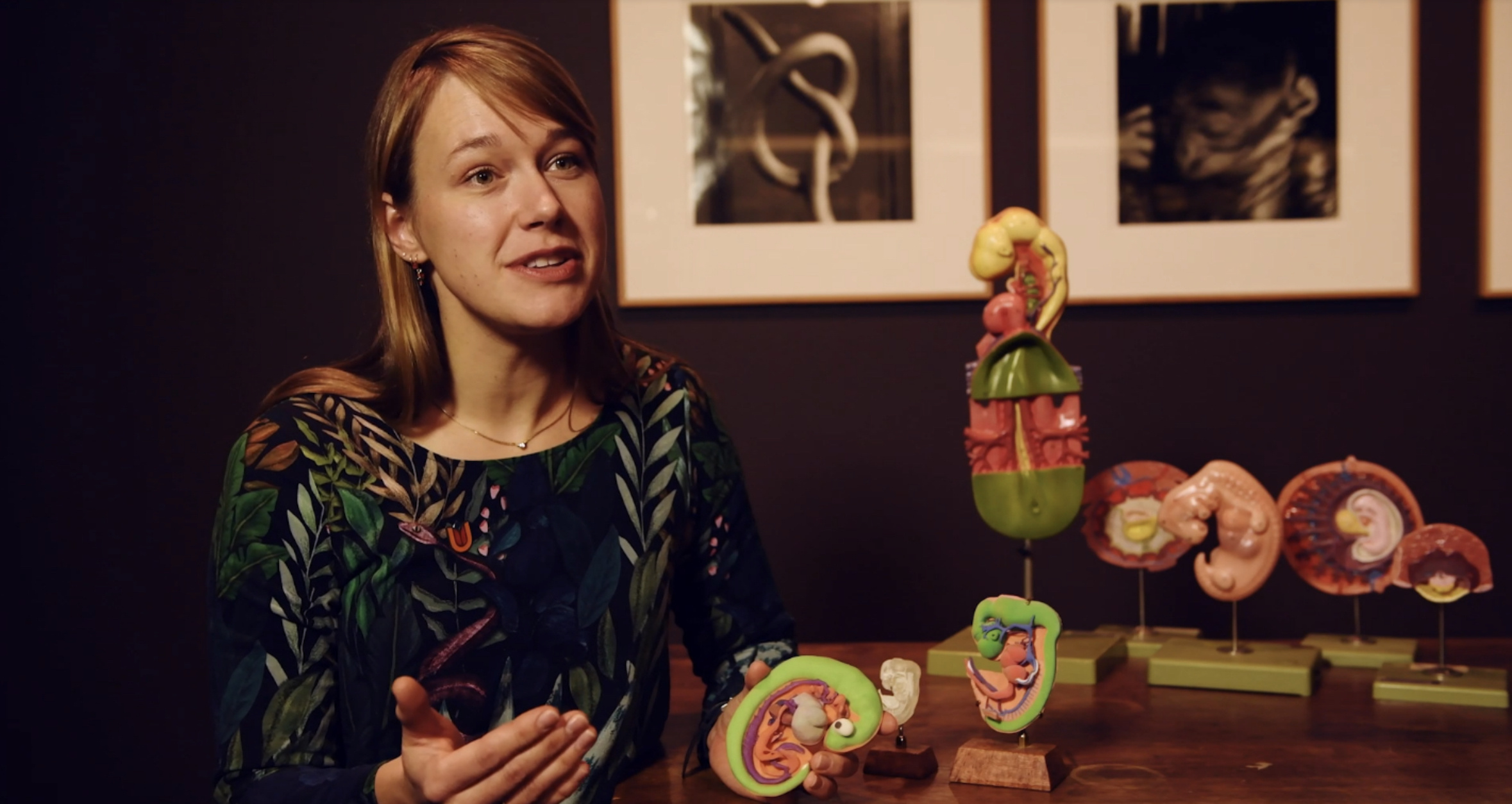 Transforming Prenatal Care: Dr. Bernadette de Bakker’s Visionary Micro-CT Research&nbsp;