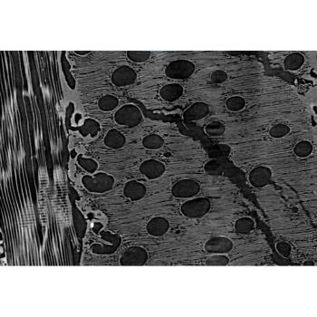 Wood laminate Dynamic to Detail | Zoom scan on the sample inside the Deben stage | HR sCMOS detector | 0.99 µm voxel size